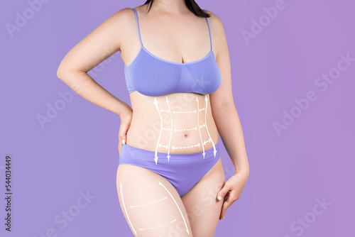 Abdomen and hips liposuction  fat and cellulite removal concept  overweight female body with painted surgical lines and arrows