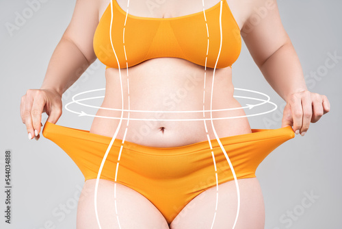 Full body liposuction, legs, hips, abdomen and breast augmentation, fat and cellulite removal concept, overweight female body with painted surgical lines and arrows