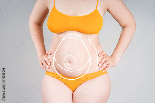 Abdomen liposuction, fat and cellulite removal concept, overweight female body with painted surgical lines and arrows photo