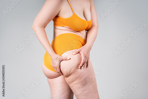 Overweight woman, fat thighs and buttocks, obesity female legs with cellulite photo