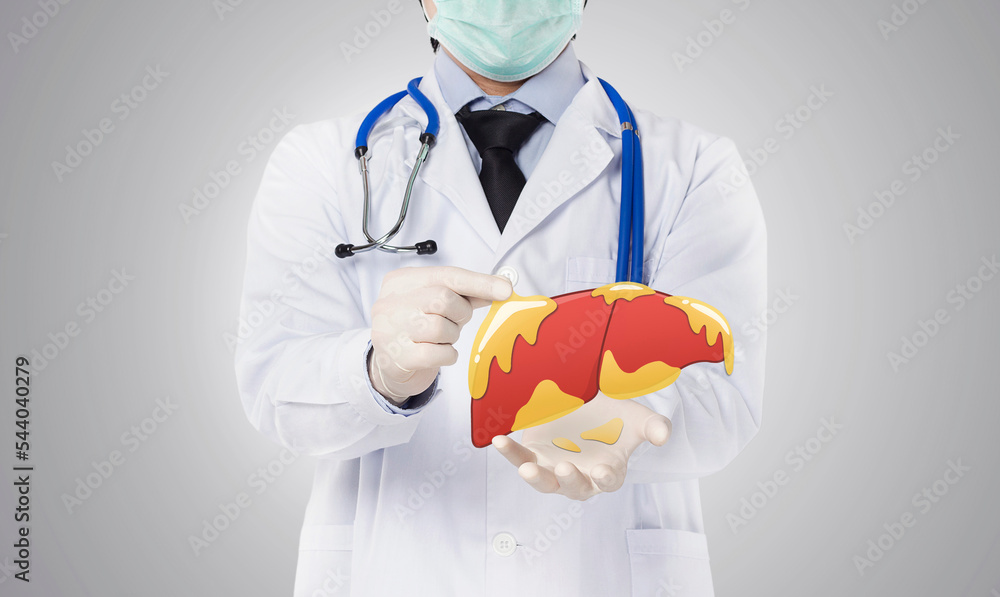 Fototapeta premium doctor showing fatty liver , liver disease