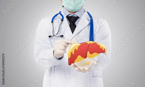 doctor showing fatty liver , liver disease photo