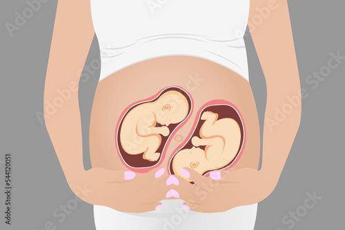 Pregnant woman with twins in the womb. Vector illustration