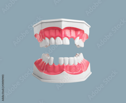 Photography Loss of teeth concept