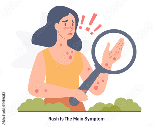 Monkeypox virus infographic. Viral infection spreading, skin rash