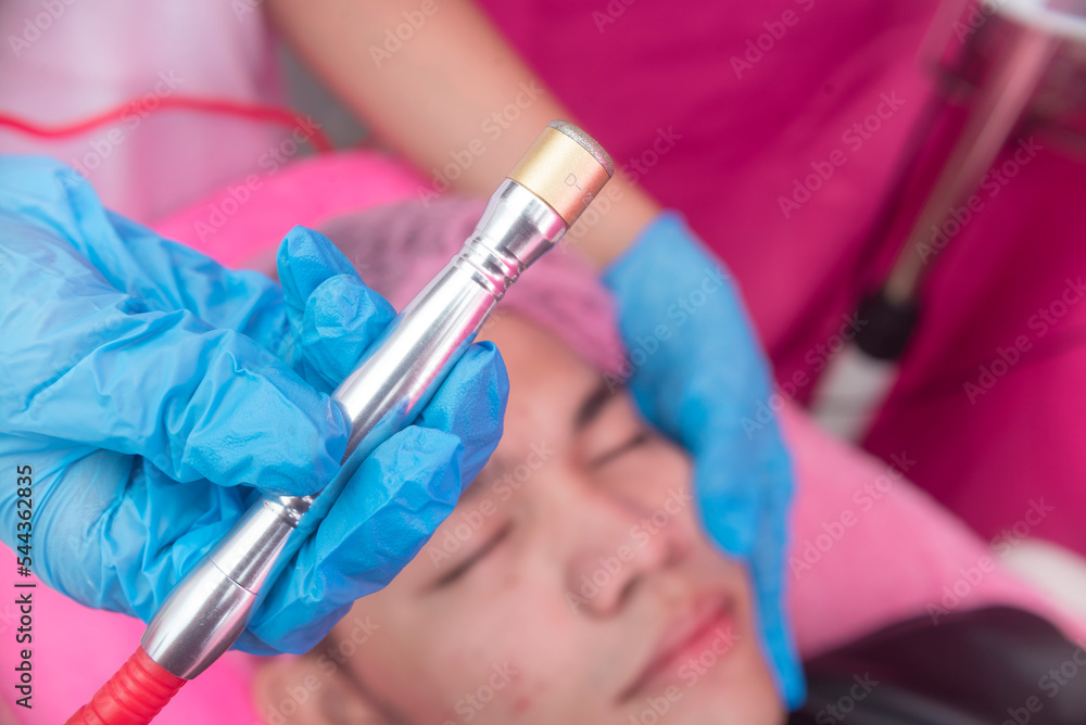 An Esthetician shows the diamond peel tool used for a microdermabrasion procedure. Exfoliating
