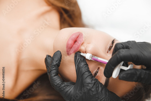 female lips  lip augmentation procedure. A syringe near a woman s mouth  injections to increase the shape of the lips