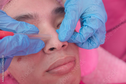 An aesthetician using a pore vacuum to clean and unclog pores on the nose area of a customer. Facial procedure and treatment at a dermatology or aesthetic clinic. photo