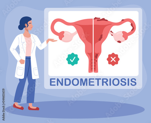 Doctor gynecologist talks about endometriosis, uterus and womens health.