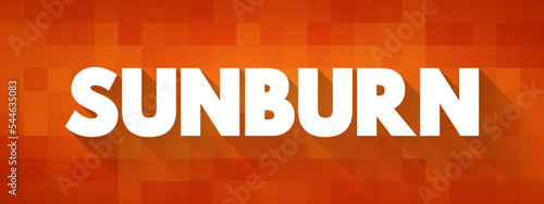 Sunburn is a form of radiation burn that affects living tissue, such as skin, text concept background