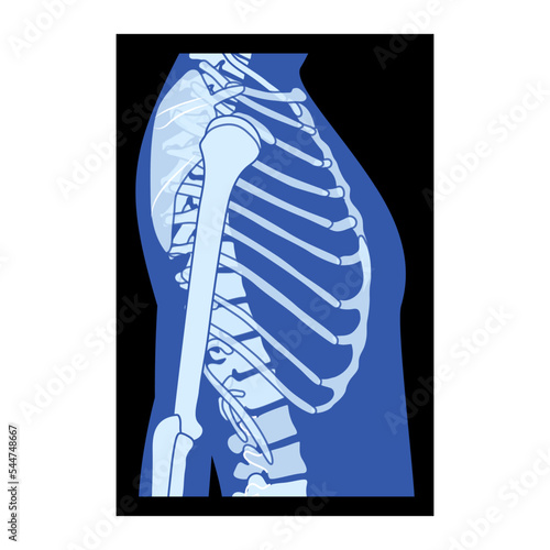 X-Ray rib cage and hands Skeleton Human body Bones adult people roentgen side view. 3D realistic flat blue color concept Vector illustration of medical anatomy isolated on black background