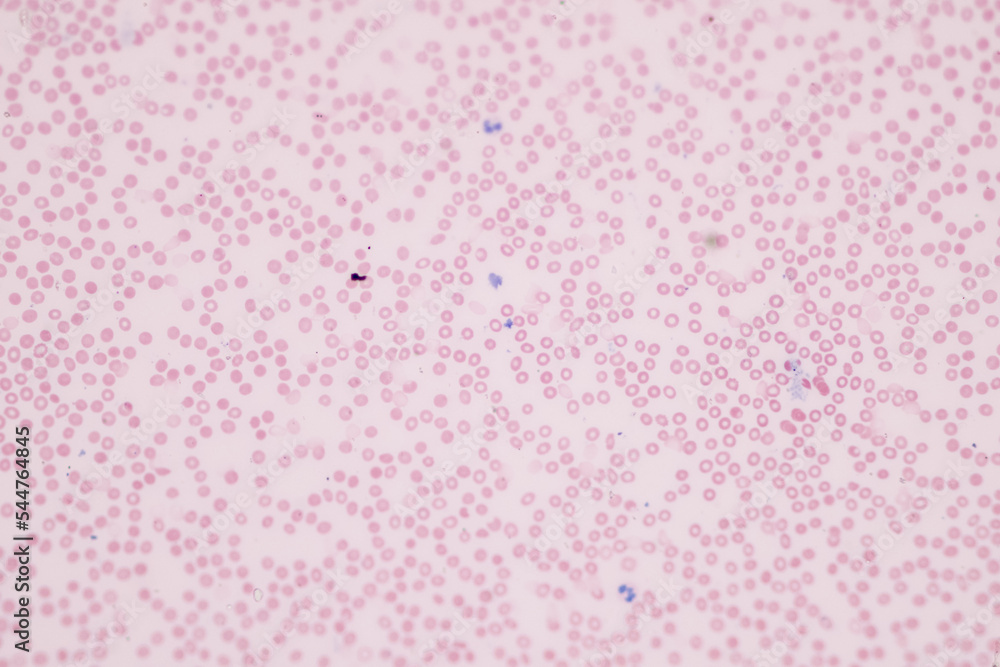 Tissue of Blood human, Vein human, Artery human and Heart muscle human under the microscope in Lab. Tissue of Blood human, Vein human, Artery human and Heart muscle human under the microscope in Lab.