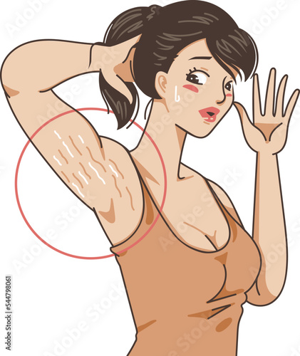 stretch marks on the armpit skin