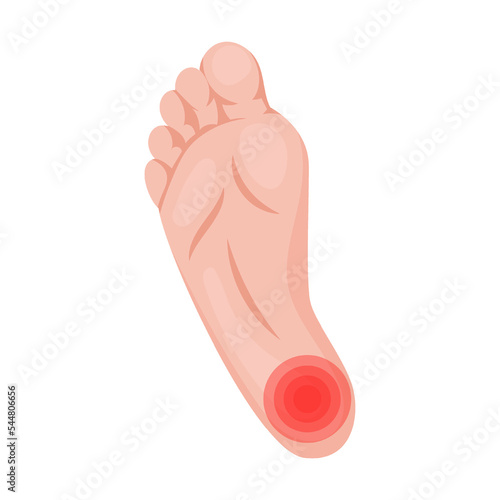 aching pain in heel, fatigue from walking. Traumas of skin on body part. Vector illustration of open cut wounds with bleeding