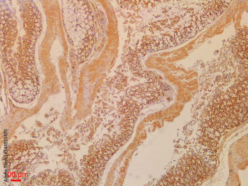 Immunohistochemistry Staining in Histopathology photo