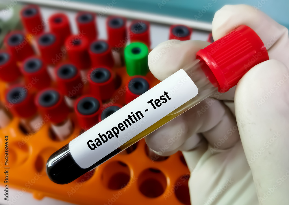 Obraz premium Blood sample for Gabapentin test. Set therapeutic dose. Epilepsy, seizures.