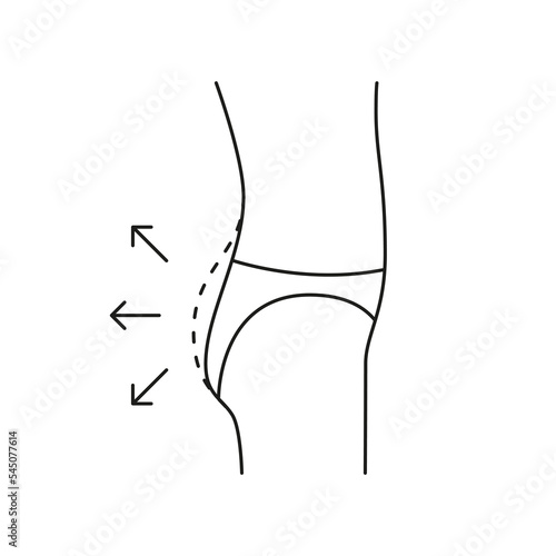 Buttock increase of woman, shape buttock side, line icon. Augmentation flat, reshape buttocks. Cosmetic medical procedures, clinic of plastic surgery. Vector outline illustration