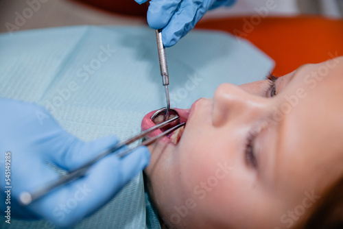 A girl of European appearance is examined by a dentist in blue gloves with the help of dental instruments. Close-up