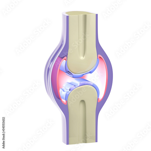 3D illustration of a synovial joint with osteoarthritis. Graphic representation of bones, tendons and cartilage on a white background. photo