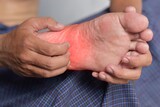 Itchy foot skin of Asian man. Concept of skin diseases such as scabies, fungal infection, rash, allergy, etc.