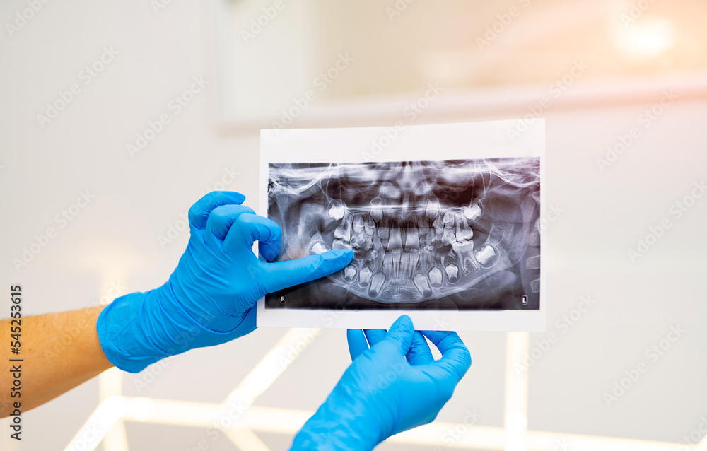 Professional radiography diagnosing. Dental x-ray examination. Professional radiography diagnosing. Dental x-ray examination.
