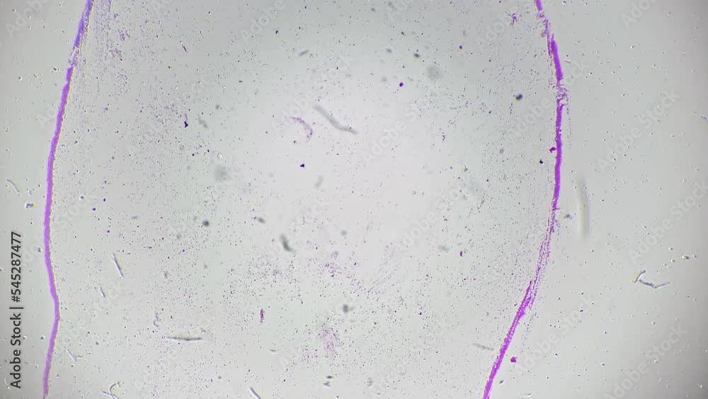 Escherichia coli smear under microscope 40x scientific slide on bright