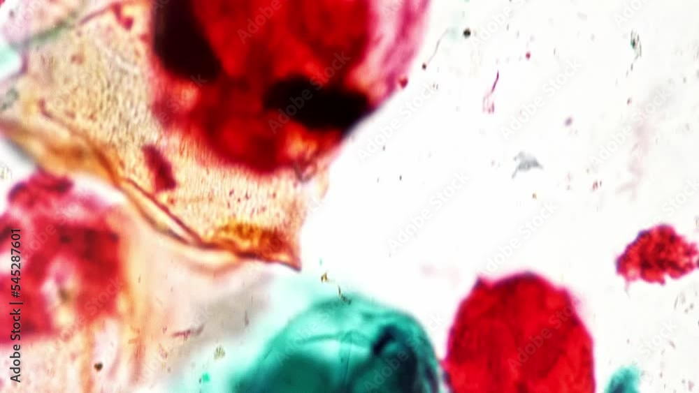 Macro footage of rotifera whole mount under laboratory microscope 400x ...