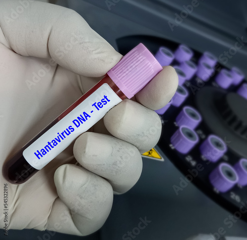 Lab Technologist hold blood sample for Hantavirus DNA test. Laboratory medical testing concept. photo