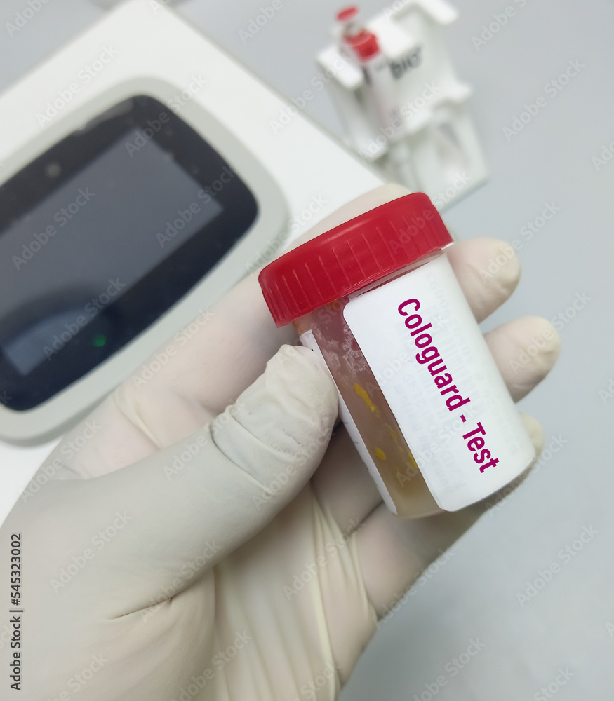 Stool sample for Fecal Cologuard test to diagnosis of colon and rectum