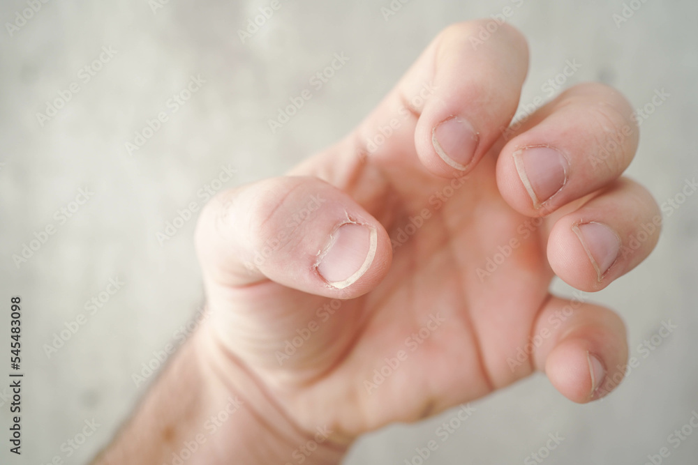 Cut the nails on the hands with nail clippers. Men's manicure. Male hand close up. Cut the nails on the hands with nail clippers. Men's manicure. Male hand close up.