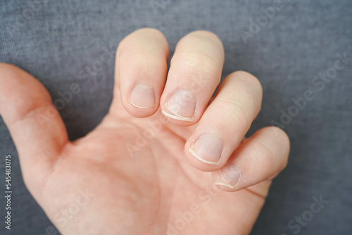Cut the nails on the hands with nail clippers. Men s manicure. Male hand close up.