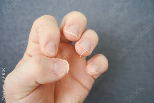 Cut the nails on the hands with nail clippers. Men's manicure. Male hand close up.