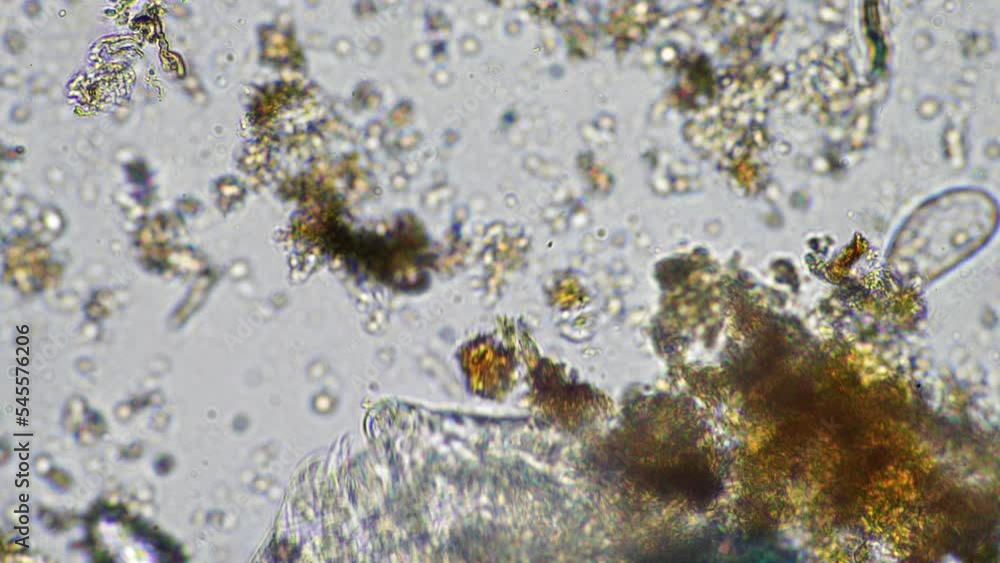 microorganisms and soil biology, with nematodes and fungi under the microscope. in a soil and compost sample microorganisms and soil biology, with nematodes and fungi under the microscope. in a soil and compost sample
