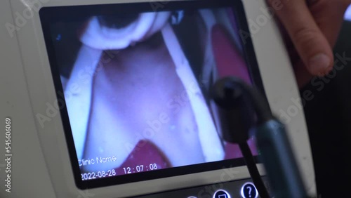 Practice of anesthesiologists on intubation of the respiratory and tracheal organs using a video laryngoscope in a hospital. photo
