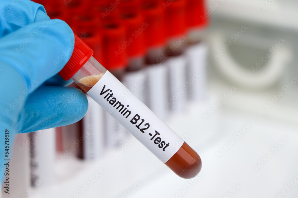 Fototapeta premium Blood samples for testing vitamin B12 in the laboratory