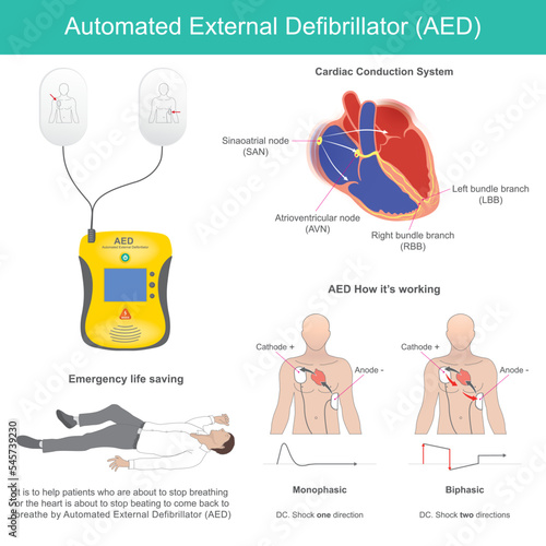 Automated External Defibrillator. It is electronic device for life support that recognises ventricular fibrillation and other dysrhythmias and delivers an electric shock at the right time..