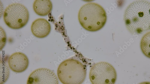 Mikroskop Film von einer kriechenden Amöbe, umgeben von der Alge Volvox, mehrere szenen mit unterschiedlicher Vergrößerung, 50 fps photo