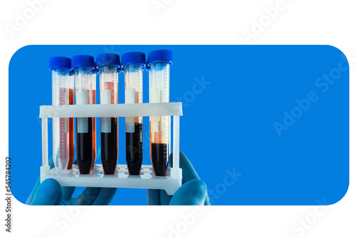 Plastic test tubes with blo...