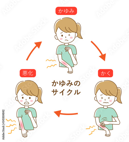 かゆみのサイクル　女性