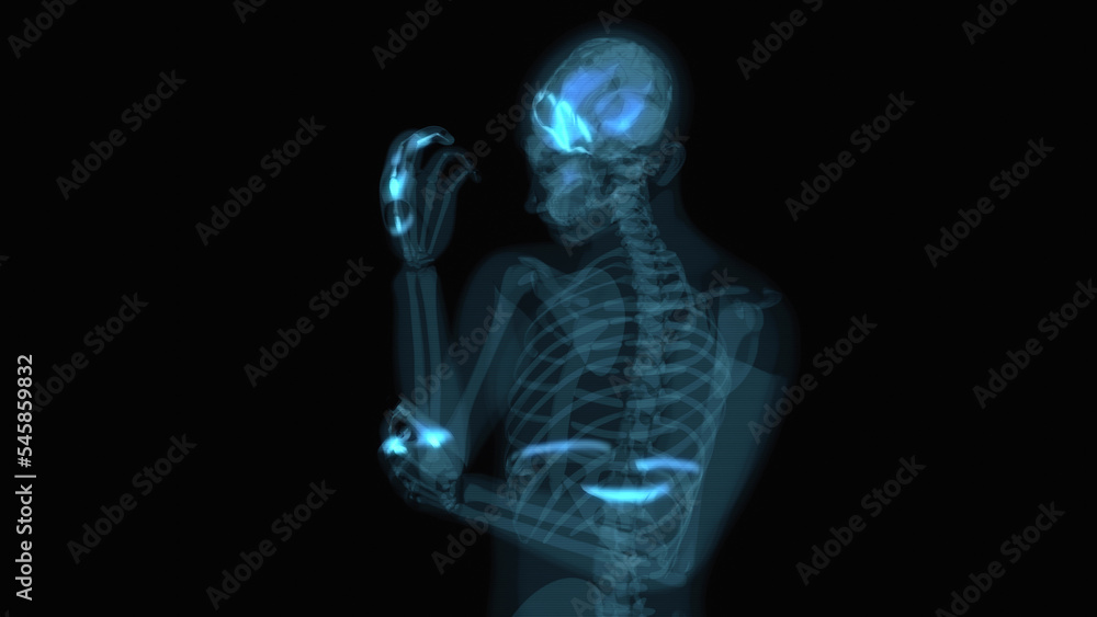 3D abstract anatomy concept of an elbow pain 3D abstract anatomy concept of an elbow pain