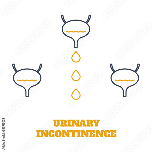 Urinary incontinence condition. Loss of bladder control. Urologic disease awareness pattern. Human body anatomy concept. Medical vector illustration.