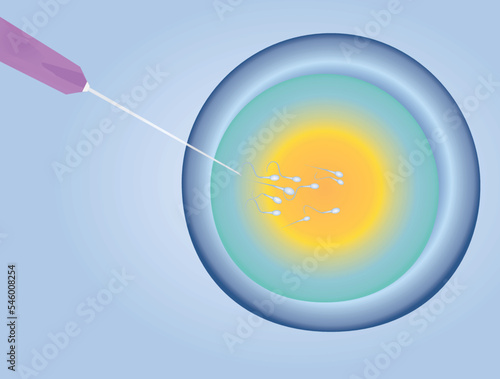 IVF insemination fertility. vector illustration