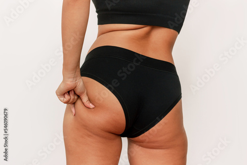 Cropped shot of a young tanned woman in black panties grabbing skin on her buttock with excess fat isolated on a white background. Buttocks and thighs with cellulite. Excess weight, overweight photo
