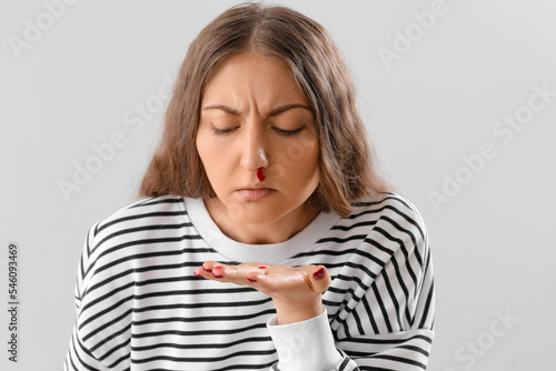 Young woman with nosebleed on light background, closeup © Pixel-Shot
