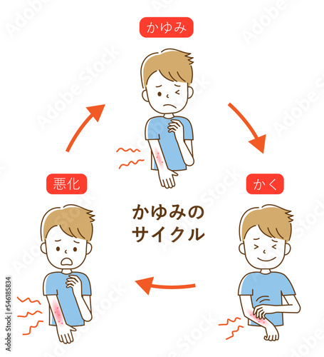 かゆみのサイクル　男性