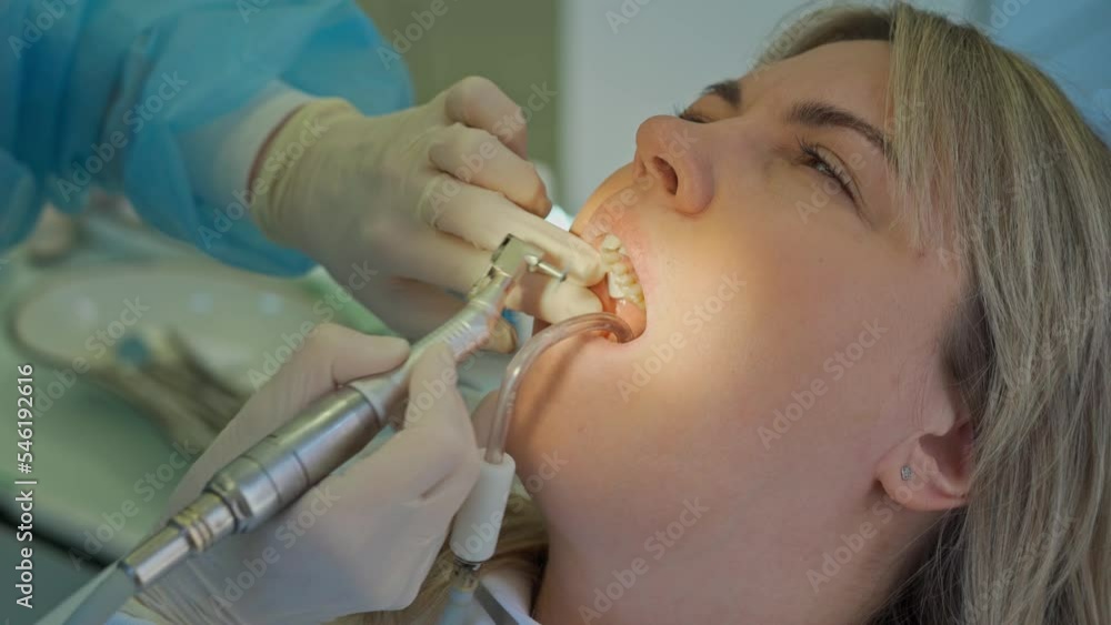 the dentist drills teeth in the mouth of a young woman with a drill