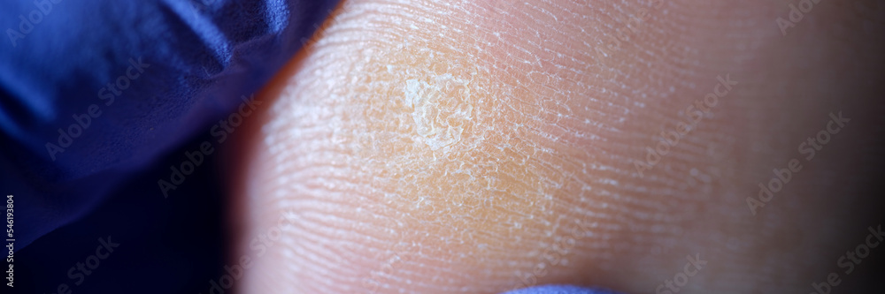 Fototapeta premium Orthopedist treats legs during a procedure in clinic