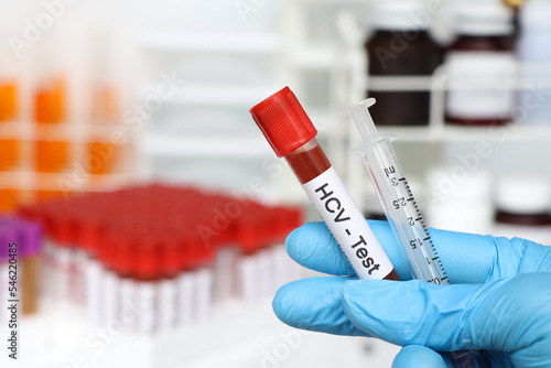 HCV Test to look for abnormalities from blood photo