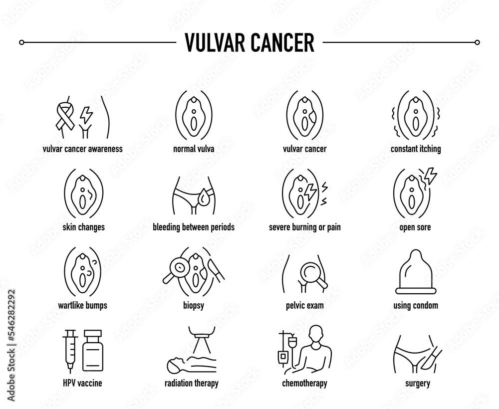 Vulvar Cancer symptoms, diagnostic and treatment vector icon set. Line editable medical icons.