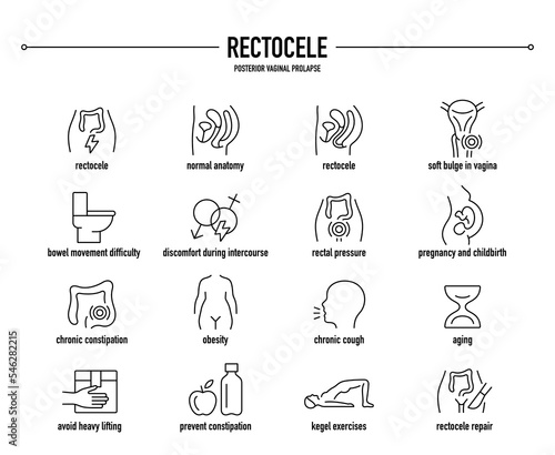 Rectocele, Posterior Vaginal Prolapse symptoms, diagnostic and treatment vector icon set. Line editable medical icons.